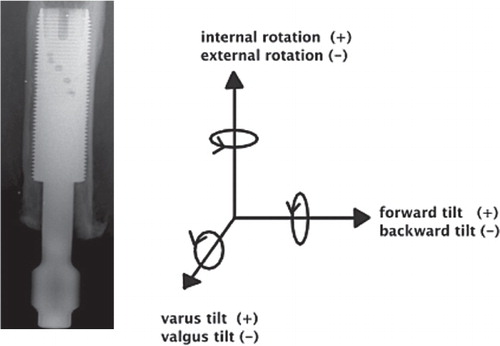 Figure 4. The defined directions of rotation of the implant.