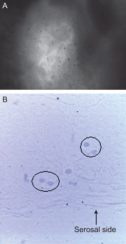Figure 9.  Interferential microscopy images of intestinal segments, including PP and perifollicular areas, from rabbit after perfusion treatment with microparticles: gut lumen surface (a), Bouin’s-fixed gut sections (spheroidal structures identified with microparticles are circled) (b). Original magnification ×40.