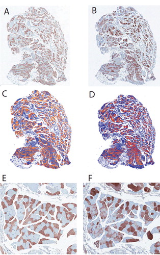 Figure 1. Immunohistochemistry of supraspinatus muscle, showing MHC1+ (left panels) and MHC2+ fibers (right panels). A and B. Serial sections were stained with the 2 relevant antibodies (see Methods for details). C and D. The same pixel selection algorithm was used to select positive staining (orange/red) and negative staining (blue). E and F. Higher-magnification view of area shown in A and B. Note the generally non-overlapping pattern of MHC1 and MHC2 immunostaining. The vast majority of myofibers have been stained with one of the antibodies, but not both, while a very small minority have not been stained with either.