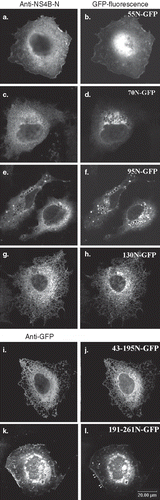 Figure 3.  Predominant localization of the GFP chimeric NS4B mutants in Huh7 cells. Huh7 cells expressing the GFP NS4B chimeric deletions were visualized 24–48 h p.t.either by indirect immunofluorescence (left panels) using the anti-NS4B-N (2.6 μg/ml) (a, c, e, g, j); or the anti-GFP pAbs (4.5 μg/ml) (k, m) and the goat anti-rabbit Alexa546 pAb or by GFP auto fluorescence (right panels). Representative confocal microscopy images are shown in black and white.