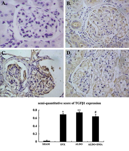 Figure 4.  Representative photographs of immunohistochemistry for TGFβ1. In rats that received 5/6 nephrectomy, TGFβ1 was observed slightly in the glomerular mesangium and the renal interstitium (B). However, in rats that received aldosterone infusion, renal injury was associated with increases in the numbers of TGFβ1-positive (C and D) cells. The numbers of TGFβ1-positive cells seemed to be much less in aldosterone DMA-treated rats compared with rats that were treated with aldosterone alone (C and D). A: SHAM group; B: SNX group; C: ALDO group; D: ALDO+DMA group. *p < 0.01 versus SHAM group; **p < 0.05 versus SNX group; #p < 0.05 versus ALDO group. Magnification: ×400.