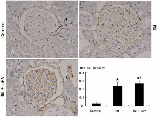 Figure 4. Glomerular uPAR expression in rats of the three groups (IHC × 400). (A) Control group. (B) Diabetic (DM) group. (C) Diabetes treated with uPA (DM + uPA) group. ☆p < 0.01, compared with control group. #p < 0.01, compared with diabetic rat group.