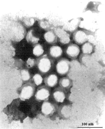 Figure 2. Transmission electron microscope photograph of budesonide nanosuspensions.