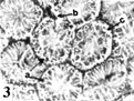 Figure 3Photomicrograph of the cross section of rat testis treated with 50 mg kg−1 day−1 for 3 days. Arrows showing (a) spermatogenesis arrest, (b) Leydig cell metaplasia, and (c) seminiferous tubule atrophy (× 160).