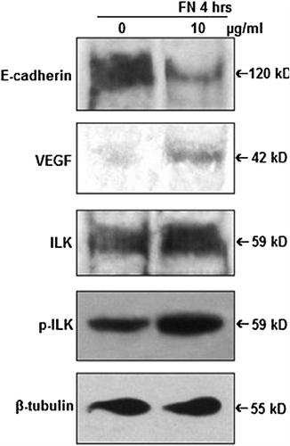 Figure 5. Effect of FN on E-cadherin, VEGF and ILK: PC-3 cells were grown in SFCM in absence (0) and in presence of 10 μg/ml FN for 4 h. Equal amounts of protein (100 μg) of cell extracts were subjected to western blot analysis with anti-E-cadherin, anti-VEGF, anti-ILK, anti-p-ILK antibodies. β-tubulin was used as internal control.