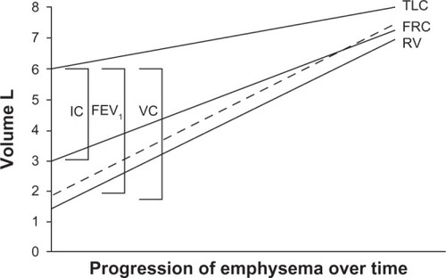 Figure 1 Schematic illustration showing that the natural history of chronic obstructive pulmonary disease is characterized by a progressive increase in gas trapping measured as a progressive increase in residual volume.