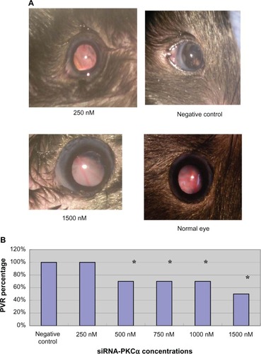 Figure 2 PVR development at 4 weeks after siRNA-PKCα injection. (A) Clinical PVR fundus photographs in the 250 nM and 1500 nM siRNA-PKCα, and in the negative control at the end of the 4-week observation period. Obvious retinal folds, epiretinal membranes, and uneven irises are observed in the 250 nM siRNA-PKCα treatment group, similar to those in the negative group; however, the radial distribution of the retinal arteries and veins are shown in the 1500 nM siRNA-PKCα. (B) Percentage in the five treatment groups and negative control.Note: The percentages in the 250 nM and negative groups are significantly different from those in the other groups. *P < 0.05.Abbreviations: PVR, proliferative vitreoretinopathy; siRNA-PKCα, small interference RNA-protein kinase C-alpha.