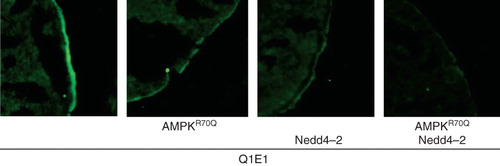 Figure 5. Similar to γR70QAMPK the ubiquitin ligase Nedd4-2 decreased the KCNQ1 protein abundance in the cell membrane. Confocal images of KCNQ1 protein abundance in the plasma membrane of Xenopus oocytes expressing KCNQ1/KCNE1 without (1st panel) or with additional coexpression of constitutively active γR70QAMPK (2nd panel), of the ubiquitin ligase Nedd4-2 (3rd panel) or of both, γR70QAMPK and Nedd4-2 (4th panel). The cells were subjected to immunofluorescent staining using FITC-conjugated antibody (grey/green).