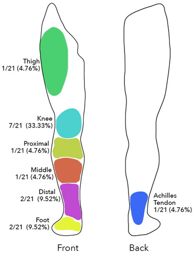 Figure 1. Diagram of lower limb representing percentage distribution of the different reconstructed areas.