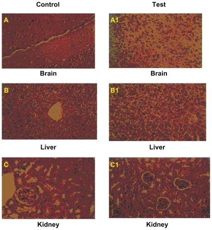 Figure 3 Histopathological slides of Brain (A control, A1 test), Liver (B control, B1 test) and Kidney (C control, C1 test), Repeated oral toxicity study of Nardostachys jatamansi treatment for 28 days in rats showed no pathological changes.