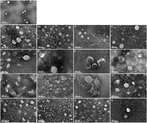 Figure 3. Transmission electron microscopic examination of exosomes isolated from plasma at different storage conditions. (a) Fresh exosomes without storage. (b–d) One-week stored exosomes with direct cryopreservationat 4°C, −20°C and −80°C, respectively. (e) One-week stored exosomes isolated from −80°C frozen plasma. (f–h) One-month stored exosomes with direct cryopreservation at 4°C, −20°C and −80°C, respectively. (i) One-month stored exosomes isolated from frozen −80°C plasma. (j–l) Two-month stored exosomes with direct cryopreservation at 4°C, −20°C and −80°C, respectively. (m) Two-month stored exosomes isolated from −80°C plasma. (n–p) Six-month stored exosomes with direct cryopreservation at 4°C, −20°C and −80°C, respectively. (q) Six-month stored exosomes isolated from −80°C frozen plasma. Direct mag: 40 000 ×, HV = 200.0 kV.