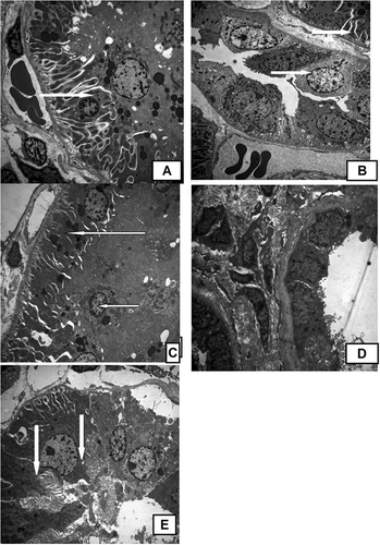 Figure 3. (A) Electron micrograph of normal rat kidney with normal ultrastructure of proximal tubules, cells with many electron-dense granules, apical vacuolations, and normal-shaped nuclei with apical microvilli and basal enfolding full of mitochondria (arrows); (B) electron micrograph of rat kidney treated with adenine with ultrastructural heterogeneity within proximal tubules, loss of microvilli, some cells show electron-dense cytoplasm, and few mitochondria (arrows); (C) electron micrograph of rat kidney treated with ginger with relatively normal proximal tubules, blood capillaries, corrugated basement membrane, wide capillary spaces, and electron-dense nuclei of blood vessels with irregular-shaped nuclei. There is increase in mesangial cells. The podocytes show dark cytoplasm with dark nuclei (arrows); (D) electron micrograph of rat kidney treated with Boswellia, showing ultrastructural damage within proximal tubules, very few electron-dense granules, and irregular-shaped nuclei of some cells; and (E) electron micrograph of rat kidney treated with AG, showing an improvement of proximal tubules, wide intercellular spaces, corrugated nuclei, thickened basement membrane, and few electron-dense granules (arrows).Note: AG, Arabic gum.
