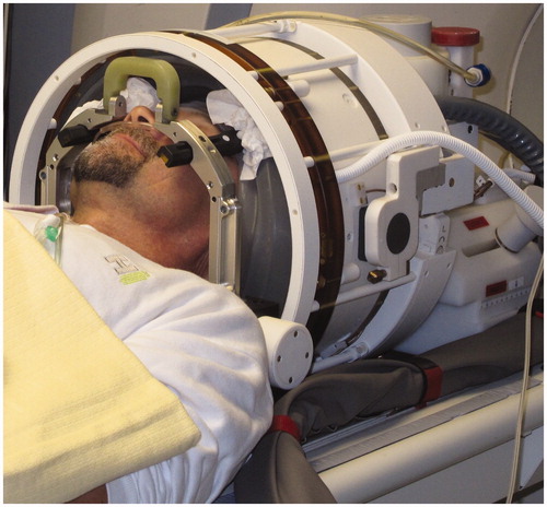 Figure 2. Photo of a patient in the ExAblate® 4000 tcFUS system.