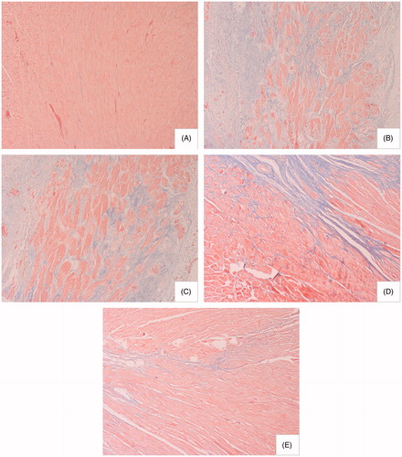 Figure 4. Effect of sophocarpine on cardiac fibrosis (Masson’s trichrome staining, × 200): (A) sham-operated rats (n = 9), (B) model rats (n = 11), (C) rats treated with sophocarpine 10 mg/kg (n = 9), (D) rats treated with sophocarpine 20 mg/kg (n = 9), and (E) rats treated with sophocarpine 40 mg/kg (n = 10).