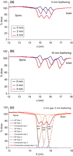 Figure 3. Comparison of dose profiles in the moving gap region between the brain and the spine fields for the three different gaps: 0, 2 and 4 mm, with (a) two 5 mm featherings, (b) two 10 mm featherings and (c) build up of the dose in the moving gap region with a 4 mm gap between the brain and the spine fields, and two 5 mm featherings. BF, brain field; Comp, composite dose; SF, spine field.