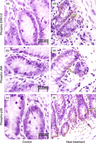 Figure 5.  Immunohistochemical analysis of phospho-ERK1/2, phospho-JNK and phospho-p38 MAPK expression in the small intestine (jejunum) crypts of rats subjected to 3 days of heat treatment (40°C for 2 h per day) or control conditions. Phosphorylation of ERK1/2, JNK, and p38 MAPK were all increased (brown stain, arrows; sections counterstained with hematoxylin, light purple) in response to heat treatment above control levels. Scale bar represents 20 μm.
