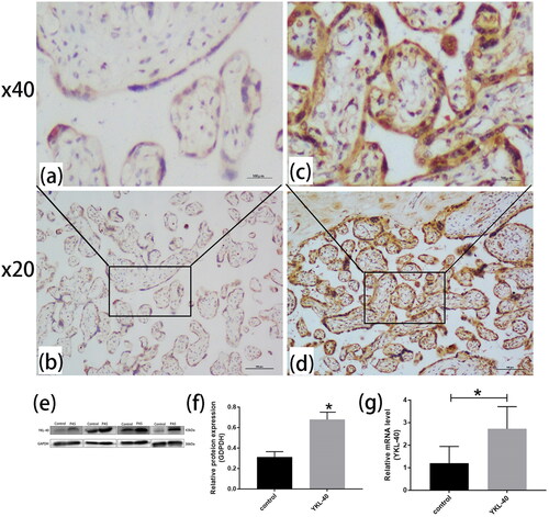 Figure 1. YKL-40 expression was higher in PAS than in control group (PAS: n = 25, control group: n = 22). Immunohistochemistry showed that YKL-40 was mainly expressed in the cell membrane and cytoplasm of placental villi. (a, b) Control group placental tissues were stained light brown, nevertheless, (c, d) PAS placental tissues were stained dark brown (magnification, ×200 and ×400, p < 0.01). In addition, (e, f) Western blotting showed YKL-40 was highly expressed in placental tissues in PAS patients than control groups (p < 0.05). (g) RT-qPCR was used to detect the expression of YKL-40 in placental tissues of PAS and control groups (P < 0.05).