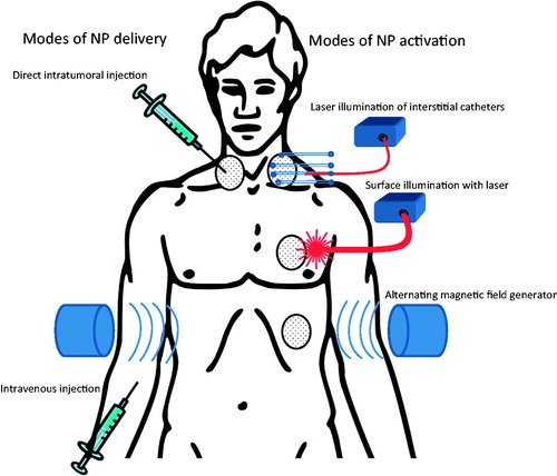 Figure 1. Schematic illustration of modes of nanoparticle delivery and activation.