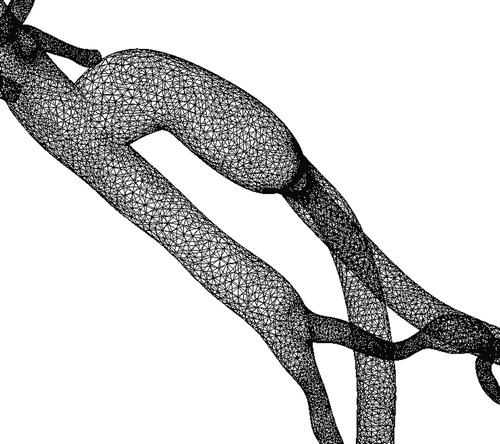 Figure 11. Exterior surface mesh for the model of the 67-year-old female patient. The mesh consists of 1.8 million tetrahedral elements.