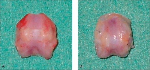 Figure 2. Typical macroscopic appearance of the regenerated tissue in the patellar grooves at 4 weeks (A) and 8 weeks (B) after surgery. A. The regenerated tissue appears slightly thicker than the surrounding normal articular cartilage.The regenerated cartilage-like tissue is opaque-white. B. The regenerated cartilage-like tissue appears translucent.The defect heals with smooth tissue, which is well integrated into the surrounding normal cartilage.