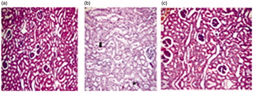 Figure 2. Photomicrographs of the hematoxylin–eosin stained kidneys from (a) control, (b) pre-natal [tubular casts (thick arrow), tubular degeneration (thin arrow)], and (c) post-natal group.