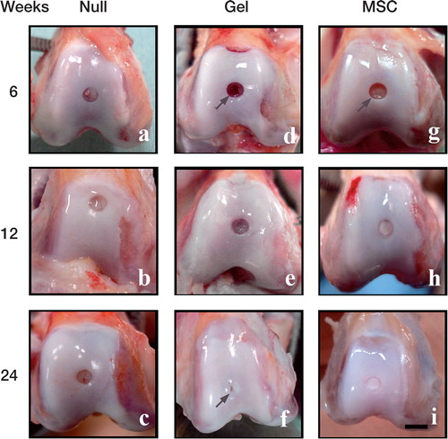 Figure 2. Macroscopic observations of the repaired defects in the 3 groups at 6 weeks (a, d, g), 12 weeks (b, e, h), and 24 weeks (c, f, i) after implantation. Scale bar: 5 mm. Arrow in (d): the sharp edge of the defect is visible at 6 weeks in the gel group. Arrow in (f): a hollow-like deformity remains in the central region of the defect, despite thick coverage by the reparative tissue. Arrow in (g): the sharp edge of the defect is also visible in the MSC group at 6 weeks.