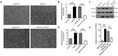 Figure 4. COL10A1 silencing mitigates the hypoxia-induced morphological changes and NGAL expression in HK-2 cells.HK-2 cells were transfected with control scrambled siRNA (NC) or COL10A1-specific siRNA for 48 h. Different groups of cells were cultured under a normoxic or hypoxic condition for 48 h. The cell morphology and relative levels of COL10A1 and NGAL expression in different groups of cells were examined. (A) Morphological observations of different groups of cells (magnification x100). (B) RT-qPCR analysis of COL10A1 mRNA transcripts in the different cell groups. (C–E) Western blot analysis of COL10A1 and NGAL expression in different groups of HK-2 cells. Data are representative images or are presented as the mean ± SD of each group (n = 3) from three independent experiments, ** p < 0.01, *** p < 0.001.