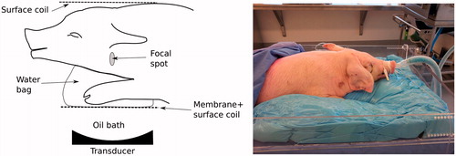 Figure 1. Schematic (left) and picture (right) of animal positioning for the experiment. The neck of the pig sits on top of a water bag used as coupling medium. Two multi-element surface coils are used for MRI acquisition. A moulding made with a foaming agent is used to immobilise the pig for the procedure.