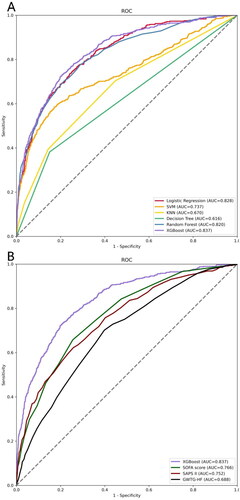 Figure 2. ROC Curves for predicting the incidence of in-hospital mortality with ML models and the traditional severity of illness scores.A ROC curves of six ML models for predicting in-hospital mortality; B ROC curves for the traditional severity of illness scores predicting in-hospital mortality. Abbreviations: ROC: receiver operating characteristic, SVM: support vector machine, KNN, k-nearest neighbors, AUC: area under the curve, SOFA: sequential organ failure assessment, SAPS II: simplified acute physiology score II.