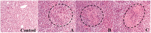 Figure 8. Histopathological examination of human glioma cells treated with Cm-Au-PLGA-PSPE nanocomposites. (A) treated at 10 μgmL−1 (B) treated at 50 μgmL−1 and (C) treated at 100 μgmL−1.
