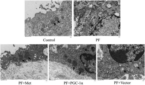 Figure 2. Mitochondrial alterations in a mouse model of PF. To determine the effect of PF on mitochondrial morphology, we observed the mitochondrial changes in PMCs in parietal peritoneal tissue using TEM. Typical TEM images are displayed (magnification ×15,000). PMCs: peritoneal mesothelial cells; TEM: transmission electron microscopy; PF: peritoneal fibrosis; PF + Met: peritoneal fibrosis + metformin; PF + PGC-1α: peritoneal fibrosis + PGC-1α overexpression; PF + Vector: peritoneal fibrosis + empty adenoviral vector.