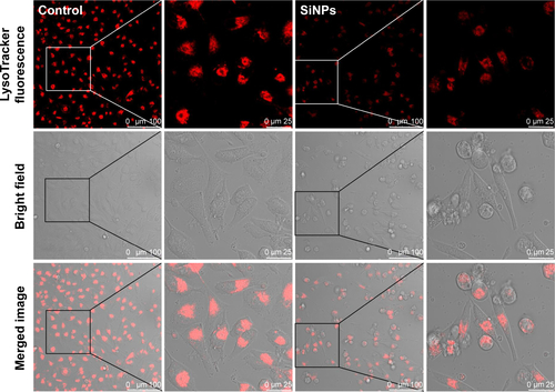 Figure S1 Lysosome impairment of HUVECs exposed to the SiNPs (50 μg/mL) for 24 hours.Notes: LysoTracker Red (Beyotime) was used for the staining of lysosome in HUVECs. Compared with the control group, the significant decrease of fluorescence intensity in the SiNPs group indicated that SiNPs induced lysosome impairment in HUVECs.Abbreviations: HUVECs, human umbilical vein endothelial cells; SiNPs, silica nanoparticles.