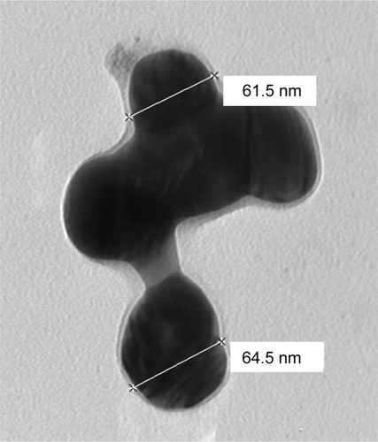 Figure 1 Transmission electron micrographs on supportive film showing the morphology of silver nanoparticles used in the experiment and indicating variable dimensions. Scale bars 61.5 and 64.5 nm.