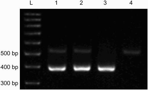 Figure 3.  An example of duplex-PCR gel-electrophoresis for SY1191 and SY1291. Lane 3 had DNA of a subject with SY1191 deletion, while lane 4 had DNA of a subject with SY1291 deletion. Lanes 1 and 2 had DNA of subjects without deletions.
