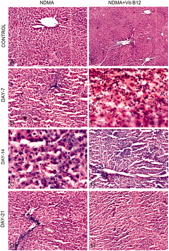 Figure 3. Hematoxylin and eosin (H & E) staining of rat liver during NDMA-induced hepatic fibrosis and subsequent treatment with vitamin B12. (A) Control liver showing central vein and characteristic lobular architecture (10 × ). (B) Day 7. Peripheral lymphocyte infiltration (4×). (C) Day 14. Demonstrating Kupffer cell hyperplasia (40×). (D) Day 21. Liver congestion, lymphocyte infiltration and well developed fibrosis (10×). (E) Control liver with normal structure subsequent to vitamin B12 treatment only (4×). (F) Day 7. Liver showing lymphocyte and neutrophilic infiltration with mild fibrosis (40×). (G) Day 14. Inflammation absent with decreased fibrosis (10×). (H) Day 21. Restoration of normal liver architecture with increasing density of regenerating hepatocytes (10×).