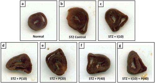Figure 1. Effect of piperine on STZ induced increased heart volume in diabetic rats