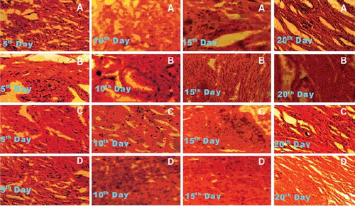 Figure 3. Photomicrographs of histologic sections of 5, 10, 15 and 20 days old wound. (A) control; (B) reference; (C) serratiopeptidase; (D) serratiopeptidase and metronidazole.