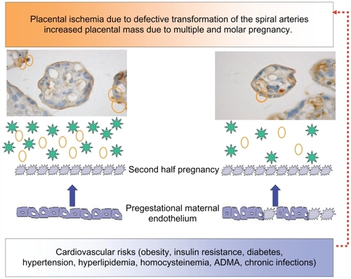 Figure 3 Diagram showing the relation between the placenta and the maternal endothelium, in ischemic conditions, increased placental mass, and underlying cardiovascular risks. The microphotographs of the placental villi show syncytial knots prior to being deported into the maternal circulation (orange circles). In addition, the placenta sheds factors to the maternal circulation (green stars: sFLT-1, agonist autoantibodies to the AT-1-R, ADMA, and reactive oxygen species). Both syncytiotrophoblast microparticles and the soluble factors provoke endothelial dysfunction in pregestational healthy (smooth borders) or dysfunctional endothelial cells (spiky borders). Pregestational endothelial dysfunction also hinders uterine artery transformation (red broken arrow).