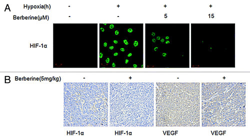 Figure 3. Berberine inhibits HIF-1α and VEGF protein expression in ESCC in vivo. (A) The nuclear location of HIF-1α was observed by laser scanning confocal microscopy using HIF-1α antibody. Representative images showing nuclear colocalization of HIF-1α (green stain) in cells under hypoxia in the presence or absence of berberine (5 μM and 15 μM). (B) Imumunohistochemical staining of HIF-1α and VEGF in tumor tissues of ECA109 xenograft bearing nude mice.