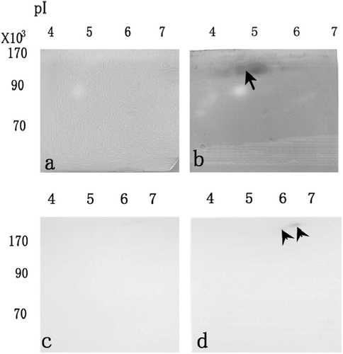 Figure 3.  After separation by non-denaturing 2-DE and electroblotting onto membrane, LDH activities staining when the membrane was treated by 0.2% oxamate (a), and washed by Tris–HCl solution (b). After separation by non-denaturing 2-DE and electroblotting onto membrane, esterase activity staining when the membrane was treated by 0.1 mM acrinol (c), and washed by aspartic acid solution (d).