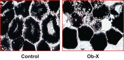 Figure 3.  Light microscopic analysis of adipocytes in visceral adipose tissue of ob/ob mice. Adipose tissues were derived from mice receiving daily oral administration of saline (control group) or Ob-X at a dose of 0.5 mg/mouse/day (Ob-X group) for 5 weeks. Representative photographs of osmium tetroxide-stained sections of adipose tissues (original magnification 400×).