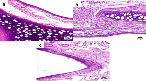 Figure 9. Histological images of the rat nasal mucosa after 5 h treatment with the intranasal dual-optimized MTC–loaded PEG-T-Chito-Lip nano-vesicular ISG (a) and intranasal raw MTC-loaded ISG (b), along with the normal untreated rat nasal mucosa (c) at time zero. The nasal cavity in all images showed apparently normal nasal mucosa (H&E).