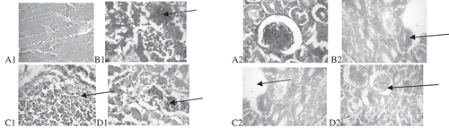 Figure 1. A histopathological view of liver (1) and kidney (2) tissues taken from broilers fed diets containing (A) 0 g/kg cyromazine, (B) 0.25 g/kg cyromazine, (C) 0.50 g/kg cyromazine and (D) 0.75 g/kg cyromazine. Arrows indicate necrosis of hepatocyte of the liver (A1-D1) and tubular necrosis and desquamation of kidney (A2-D2). Magnification x400.