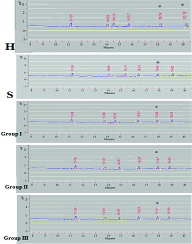 Figure 5.  Chromatogram of fatty acid analysis of phosphatidylcholine (PC) as representative of the phospholipids of erythrocyte membrane in various groups of patients having COPD (Group I-III), healthy smokers (S) and healthy non-smokers (H). H = Healthy non-smokers, S = Healthy smokers, Group I = Patients of COPD stage II, Group II = Patients of COPD stage III, Group III = Patients of COPD stage IV.