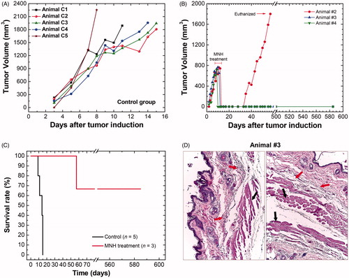 Figure 2. (A) Tumoral time-evolution of the control group (n = 5), animals also bearing a solid and subcutaneous Ehrlich tumor, that did not undergo the MNH nor receive MalbIR injection. (B) Tumoral time-evolution of the treated animals #2, #3 and #4 by in vivo MNH with MalbIR nanocarriers intratumoral injection (single session of 30 min of exposure to an AMF of 17.5 kA.m−1 and 301 kHz). (B) Kaplan–Meier’s curves of the control group (in black, they were euthanized when their tumors reached 2000 mm3) and the treated animals #2, #3 and #4 (in red). (C) Histological sections of the skin of animal #3, extracted from the same region where the tumor had previously been induced, but 575 days after the MNH treatment. The red arrows indicate fibrotic regions and the black arrows indicate the dermis and muscle tissue.