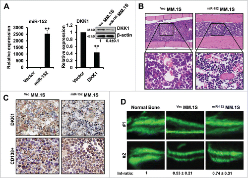 Figure 6. Over-expression of miR-152 alleviates bone destruction in MM in vivo. (A) Stably expressing miR-152 or empty vector infected MM.1S cells were injected into bone marrow of mice for the development of MM. Levels of miR-152 (left panel) and DKK1 mRNA and protein (right panel) are obtained from the mice bone marrow, when the disease is confirmed. Statistical significances at **p < 0.001 vs. empty vector from 3 independent experiments. (B) H&E staining showing equal and successful injection of 0.5×106 VecMM.1S and miR-152MM.1S cells into mice bone marrow. (C) Representative immunohistochemical staining of DKK1 (upper panel) and CD138+ (lower panel) in the VecMM.1S and miR-152MM.1S cells obtained from the mice bone marrow. (D) Representative fluorescent micrographs of dual calcein labeling of femur bone from 2 mice injected with 0.5×106 VecMM.1S and miR-152MM.1S cells. The distance between the 2 calcein labeling layers reflects the bone mineralization rate, and the analysis of the intensity ratio between the VecMM.1S group and the miR-152MM.1S groups were shown at the bottom. Bars represent the mean ± SEM of n = 10 mice per group (*P < 0.05).