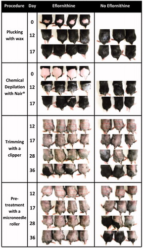 Figure 1. Digital photographs of C57BL/6 mouse dorsal skin with and without treatment with the Vaniqa eflornithine cream (13.9%) for up to 36 days. The hair on the application area was removed by plucking using GiGi® Honee warm wax, chemical depilation using Nair® or trimming with a clipper. In one group (bottom), following trimming, the skin area was also treated with a microneedle roller (microneedle length, 500 µm; base diameter, 50 µm) every time before the application of the eflornithine cream. The rectangles indicate the mouse skin area where the eflornithine cream was applied. For a full-color version of the figure, the reader is referred to the online version of the article.