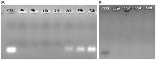 Figure 4. The stability analysis of siRNA-loaded ChiNPs in serum and heparin challenges. (A) The stability of siRNA-loaded ChiNP/CMD against FBS after 72 h incubation. Naked siRNA was considered as control (CTRL). (B) The stability of siRNA-loaded ChiNP/CMD against different volumes of heparin (2 μg/mL) after 1 h incubation. Naked siRNA was considered as positive control (CTRL).