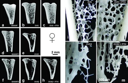 Figure 3.  Tibial metaphysis from female rats. Representative anorganic sections from female rats in prevention (a–c) and intervention experiments (d–h). Note that in OVX groups (b,d,e) there is trabecular bone loss in the central zone. Detail of the trabecular microarchitecture (i–m) as viewed by stereoscopic zoom microscopy. Note in OVX2 (l) the extreme trabecular thinning.