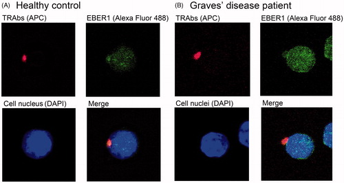 Figure 2. Images of TRAbs(+) EBV(+) double-positive cells from a healthy control (A) and a Graves’ disease patient (B). Cell surface TRAbs were stained as red spots of APC. The granular signals of Alexa Fluor 488 showed EBV encoded small RNA (EBER) 1 in the nuclear structures. The Alexa Fluor 488 signal was also observed in the cytoplasm, and a deep blue DAPI signal represented the cell nucleus. Abbreviations: APC, allophycocyanin; DAPI, 4′, 6-diamidino-2-phenylindole; EBER, EBV-encoded small RNA; EBV, Epstein–Barr virus, human herpesvirus 4; TRAbs, thyrotropin receptor antibodies.